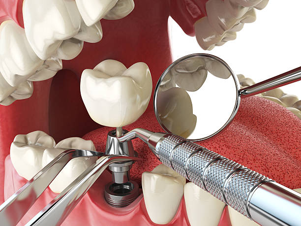Best Urgent Dental Care for Toothache in Bradner, OH