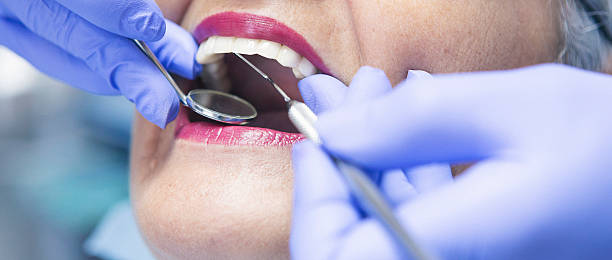 Best Emergency Dentist for Lost Fillings or Crowns in Bradner, OH